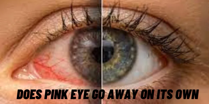 Does Pink Eye Go Away On Its Own