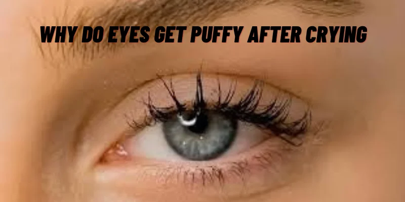 Why Do Eyes Get Puffy After Crying